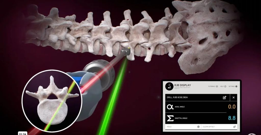 3D video for medical product mechanism